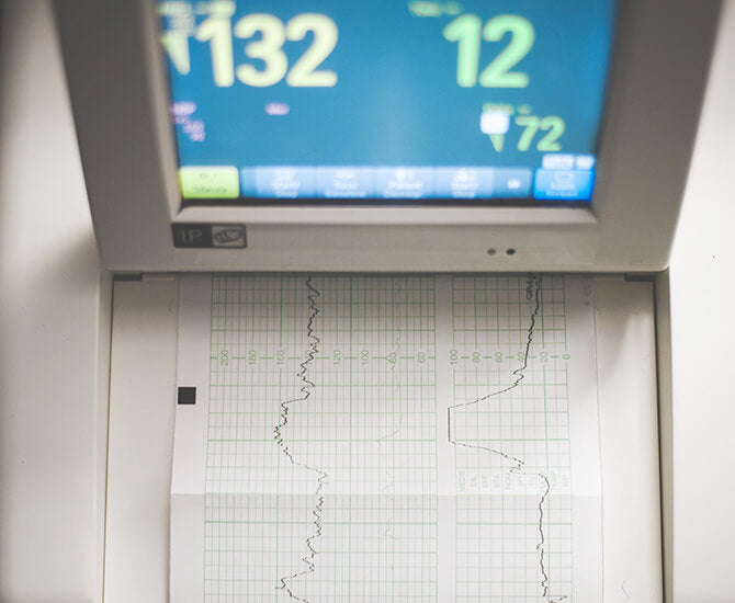 How to maintain ECG Machines
