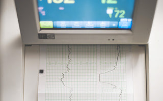 How to maintain ECG Machines