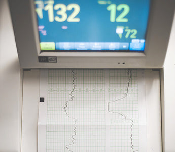 How to maintain ECG Machines