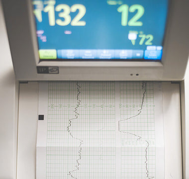 How to maintain ECG Machines